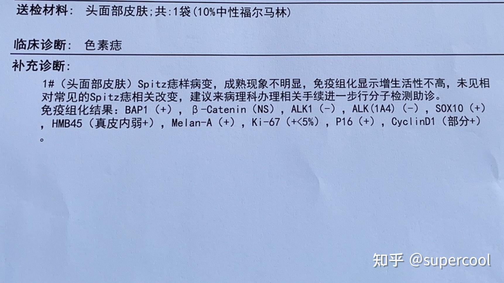 黑色素瘤spitz痣一场艰难漫长去痣过程