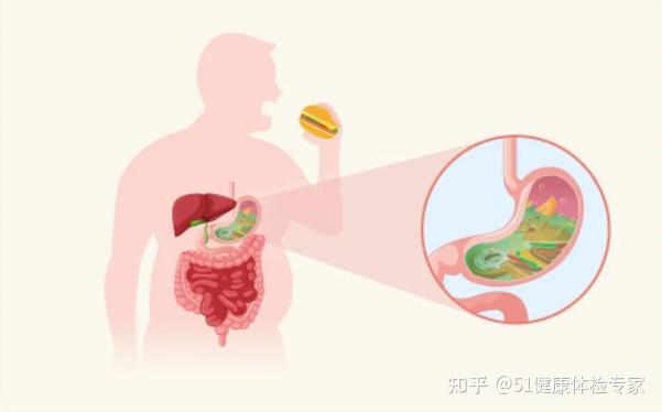 打嗝、反酸、烧心总不好？你可能陷入误区了！ - 知乎