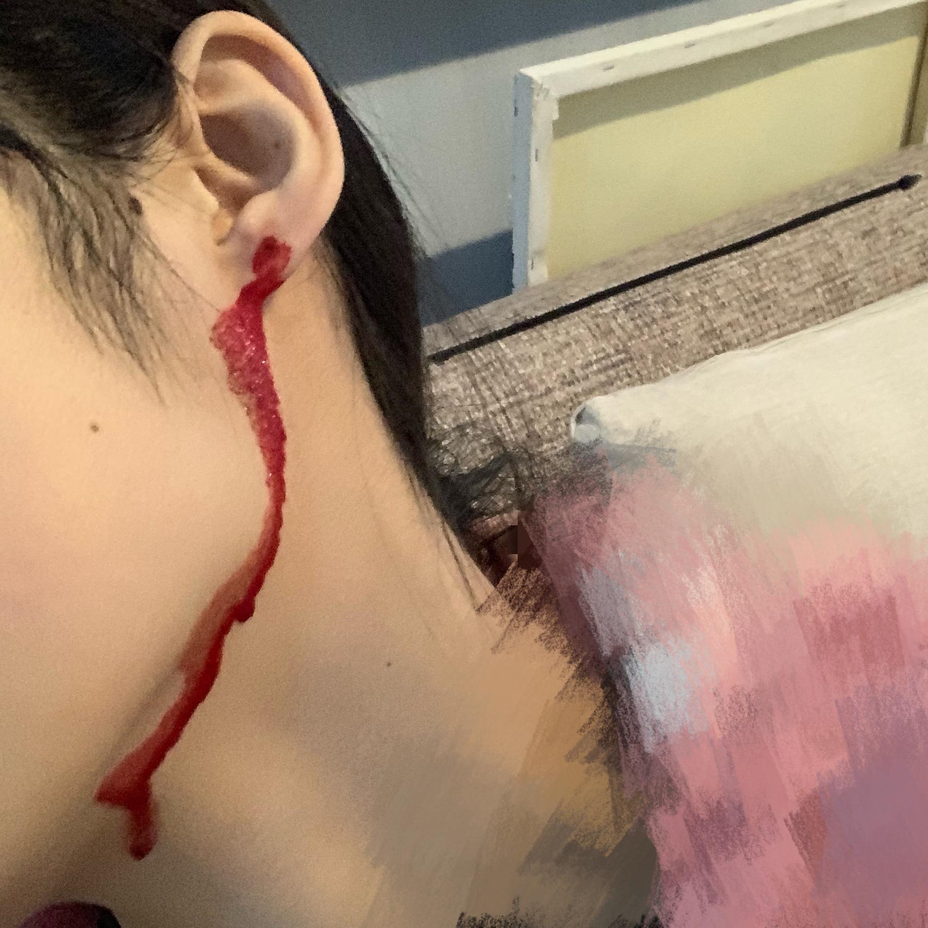 为什么打耳洞不会流血