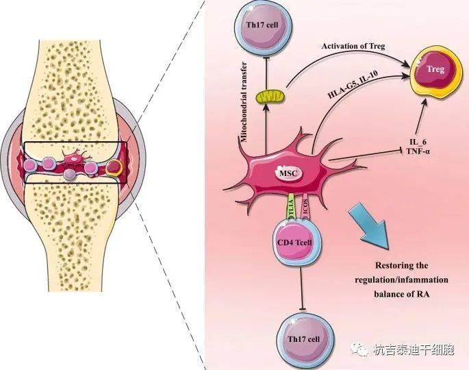 幹細胞移植治療類風溼關節炎的作用機制研究