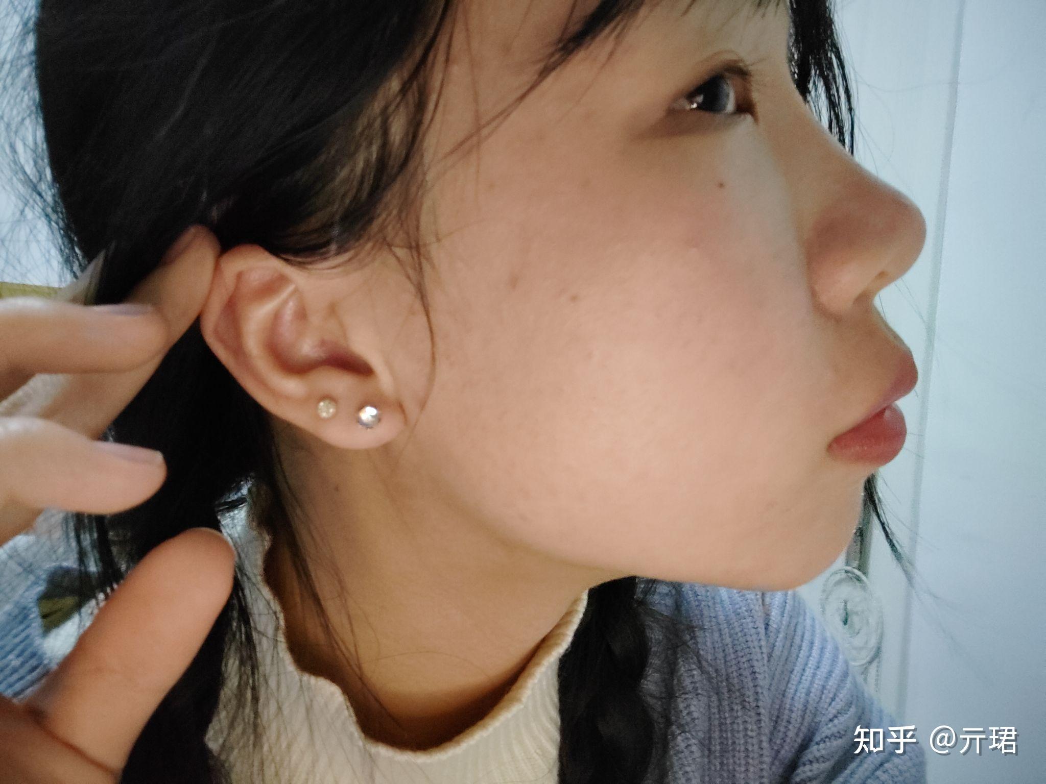 有眼尾沟的眼睛好看吗? - 知乎