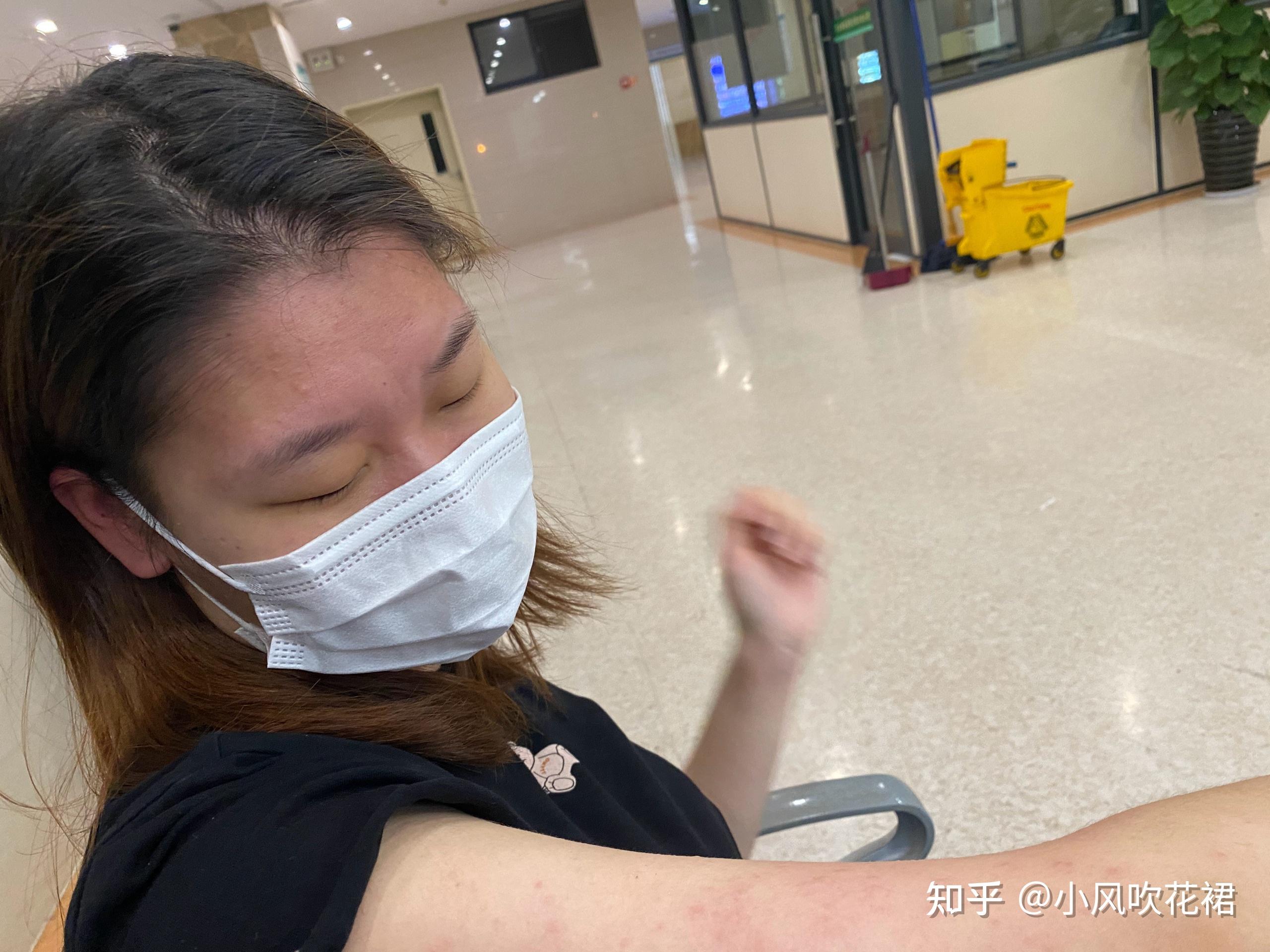 晚上虾过敏是什么感受