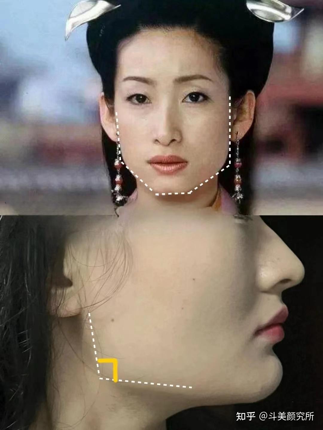 方脸变美攻略:方脸怎么远离土气变高级,医美、发型、配饰一文讲清楚,方形脸姐妹必看!!! - 知乎
