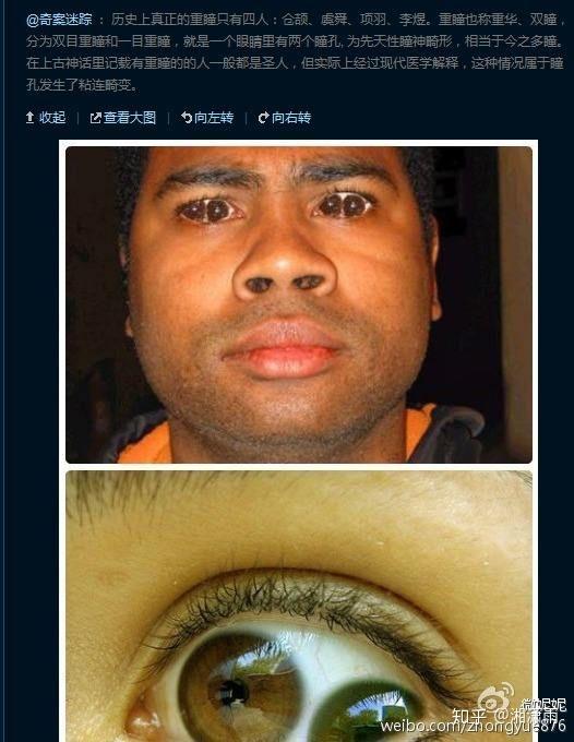 重瞳者都是古代传说现在网络这么发达能不能找到天生重瞳的人