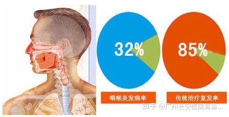 咽喉炎有什么症状有哪些 - 知乎