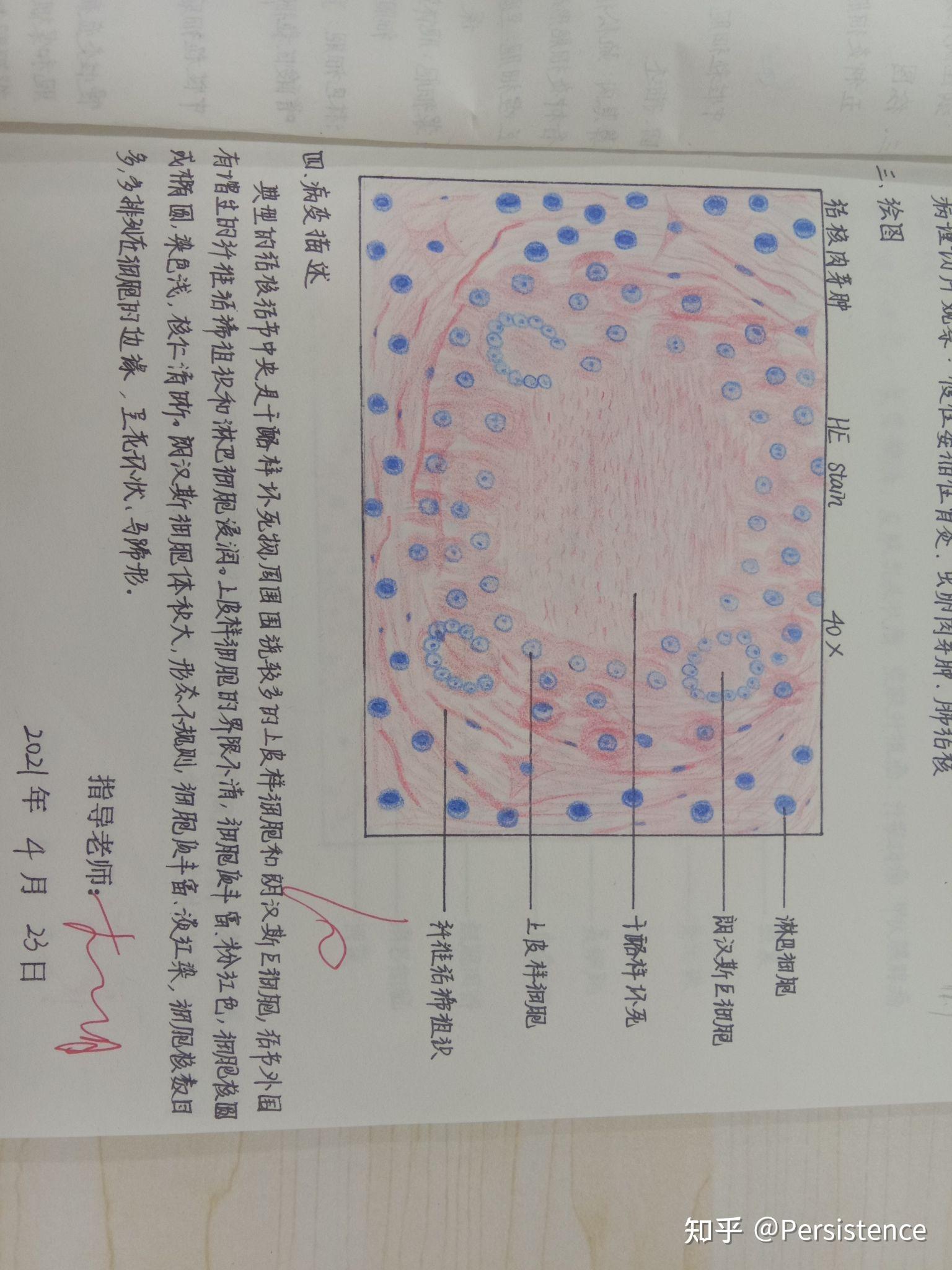 病理学红蓝铅笔手绘图