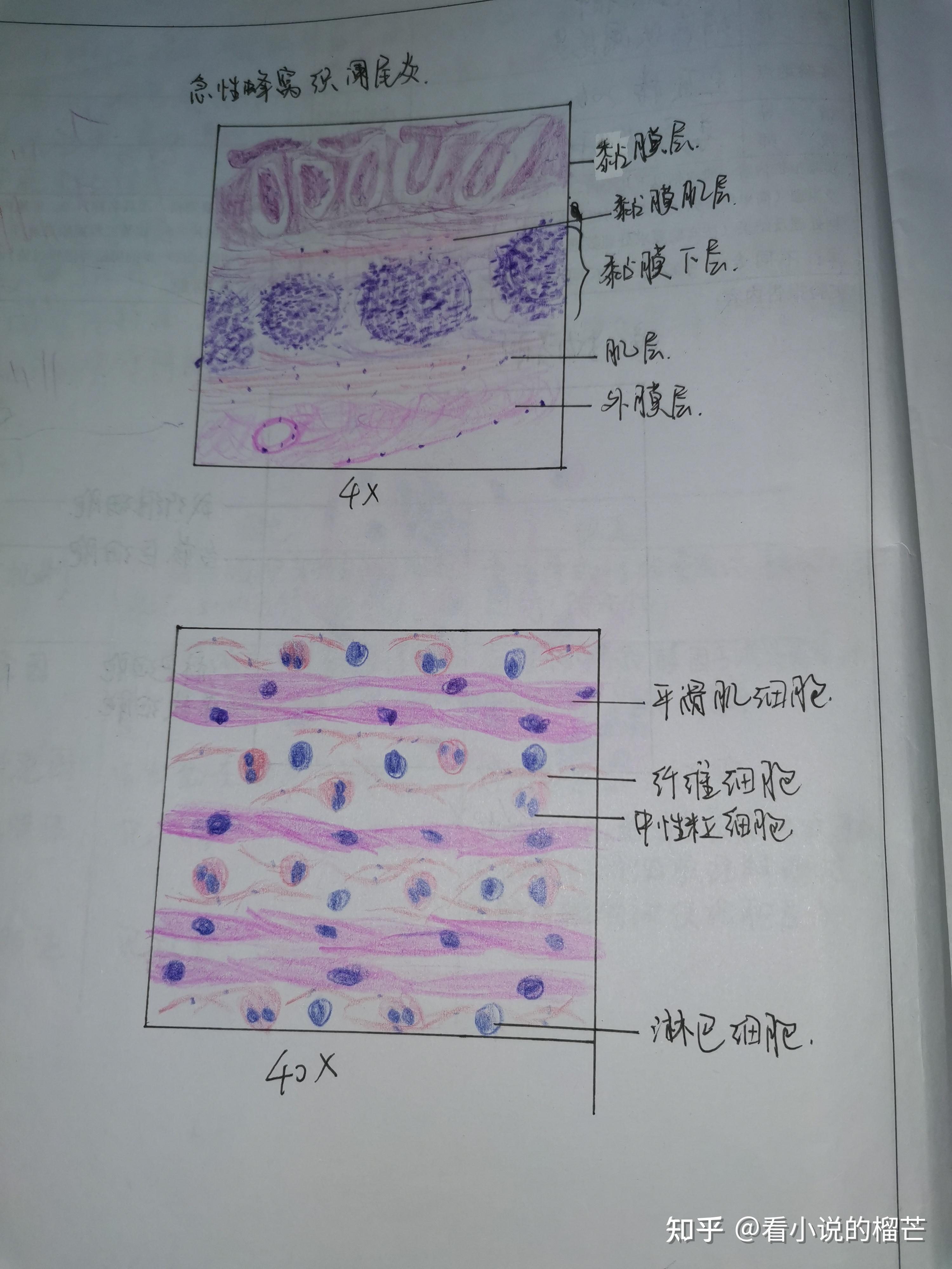 各种炎细胞手绘红蓝图图片
