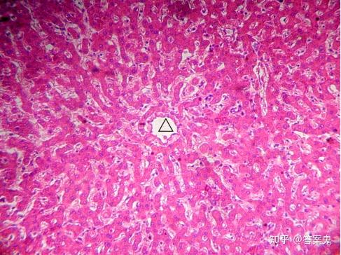 10) 肝小叶由中央静脉()及周围大致呈放射状排列的肝索和肝血窦所组成