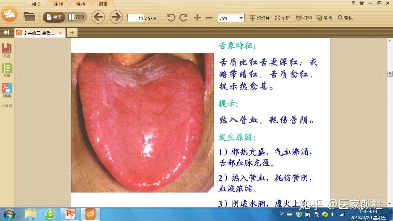 从零开始学中医：望舌下络脉 - 哔哩哔哩