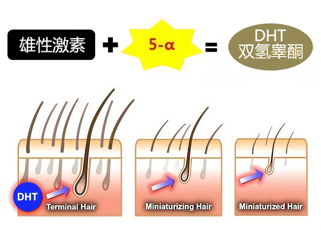 前端工作同事大部分都脱发了虽然我发量挺多的但害怕脱发有什么推荐的