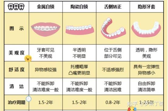 做了牙齿矫正一定会形成牙套脸吗?