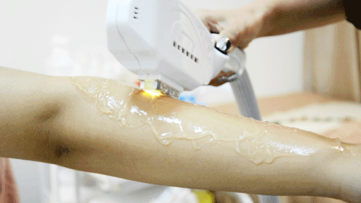 秋季脱毛进行时选对方法很重胡文文