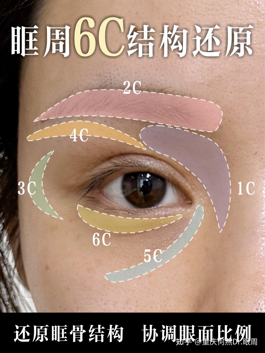 眼周6C结构还原年轻态 - 知乎
