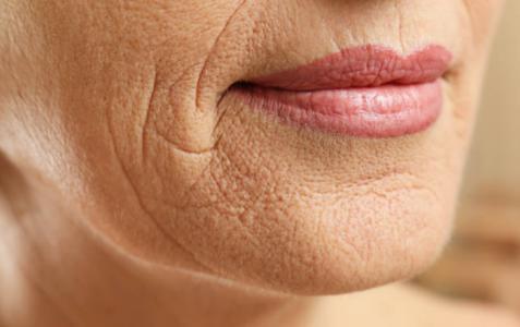 年轻女性怎样解决面部皮肤松弛问题?