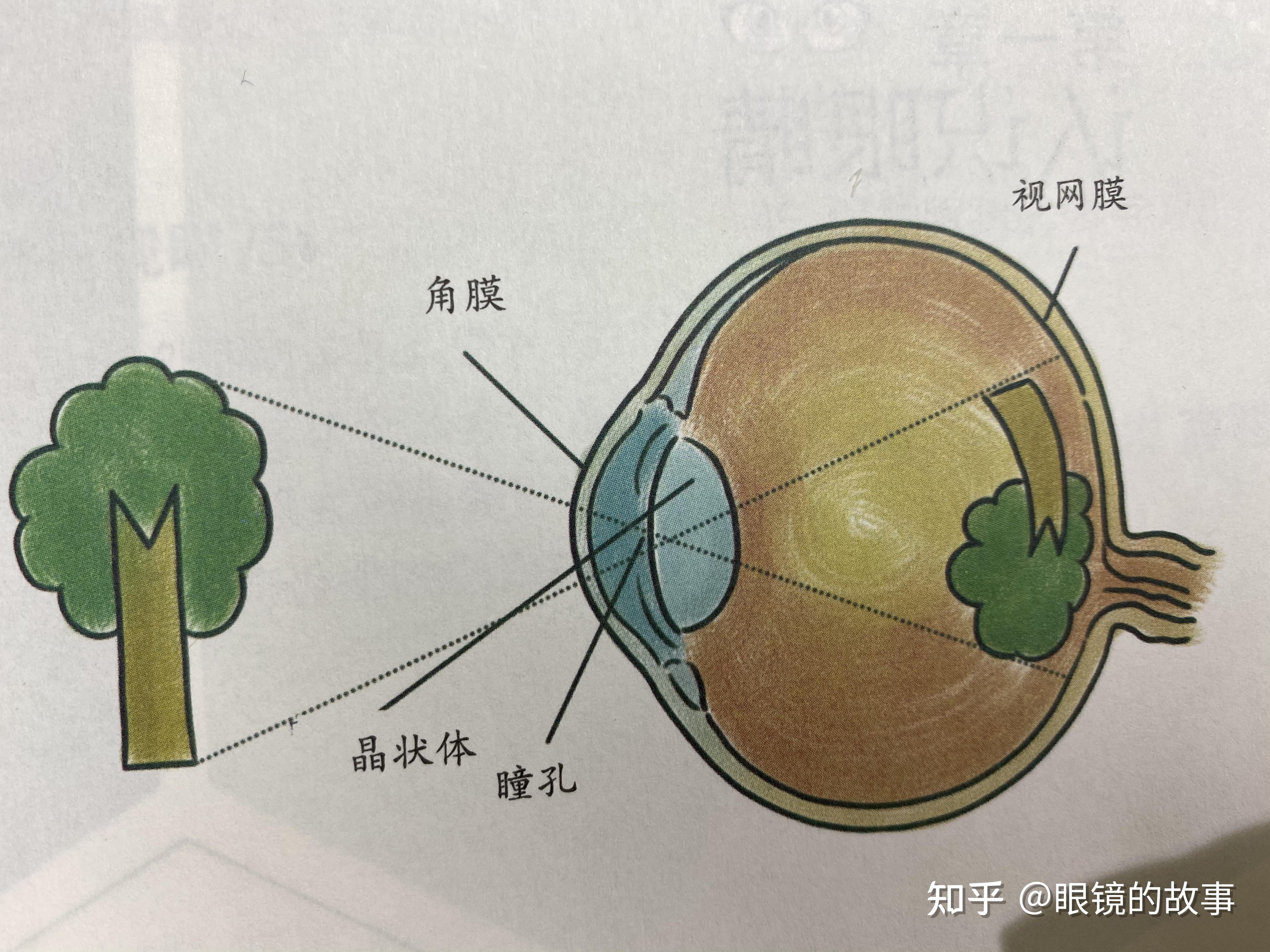 简述眼睛的结构