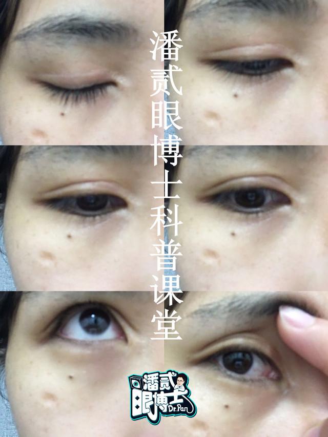 v2-01cef50e568a0c7be9dd37c6ccbd4ac7_1440w.jpg?source=172ae18b