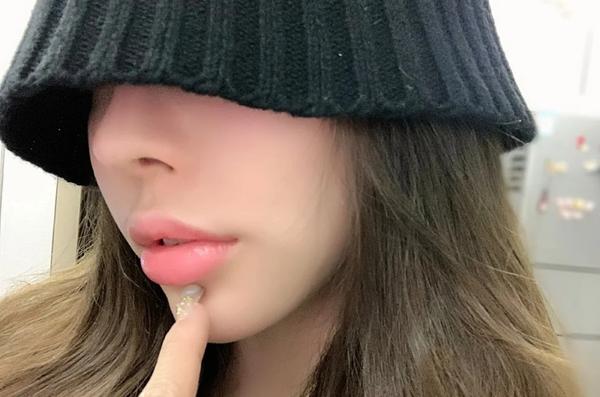 下面给大家分享一些成都m唇案例