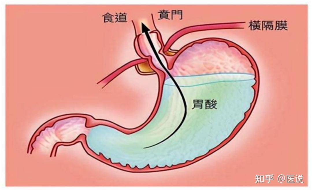 胃幽门图解图片