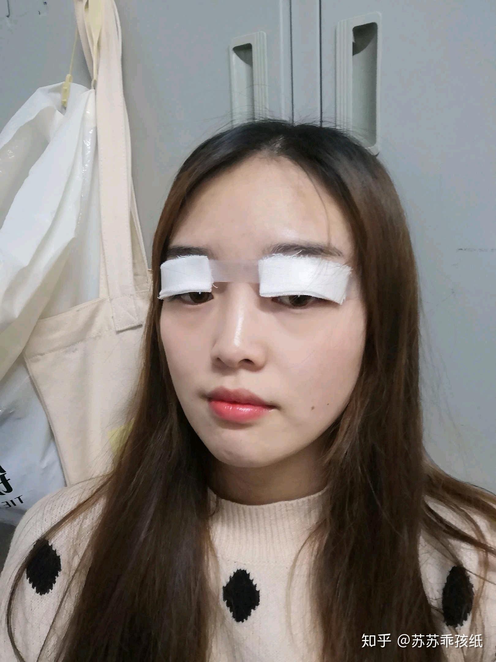 郑州双眼皮自然风格的医生有哪些？ - 知乎