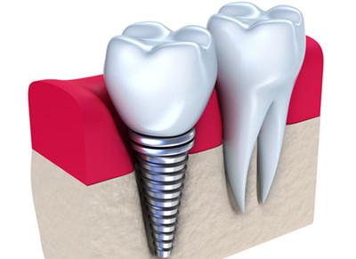 v2-0218bd2e1909f816694cc283ac78098a_1440w.jpg?source=172ae18b