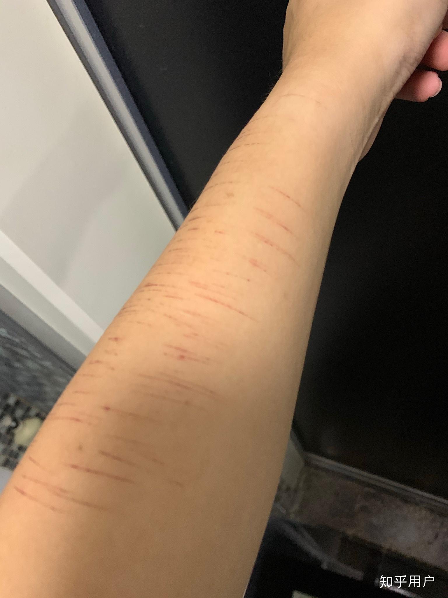 自残属于什么心理