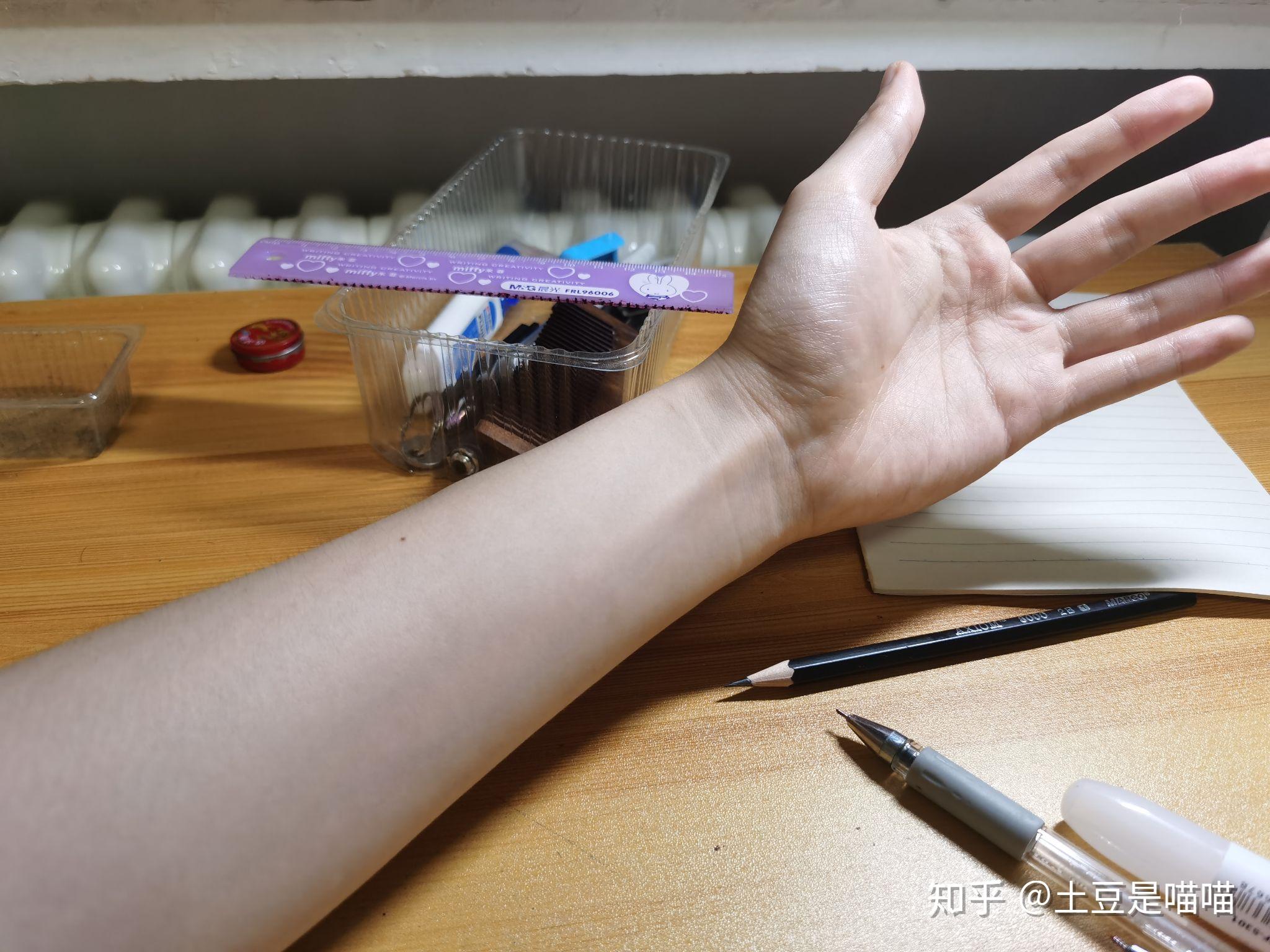 你见过最细的手腕是多细? - 知乎