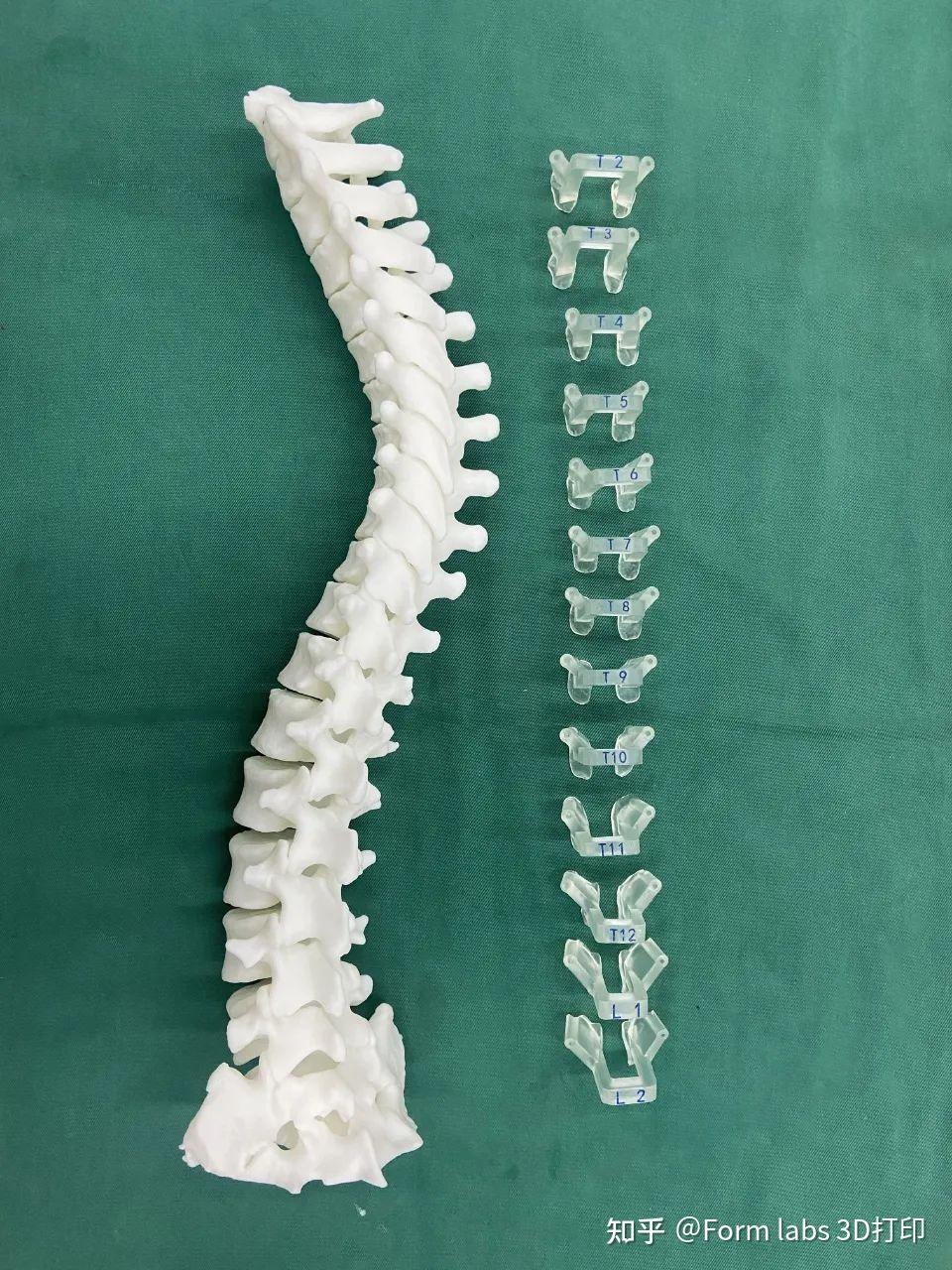 3D打印手术导板在三甲医院应用实例:高效、精确匹配不同手术类型 - 知乎