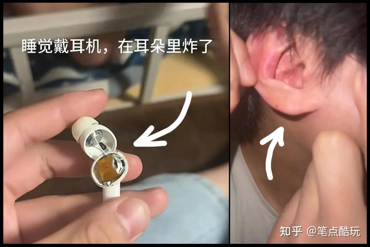 买耳机莫贪便宜,爆炸伤人悔之晚矣!教你选对开放式耳机 | 南卡Wing