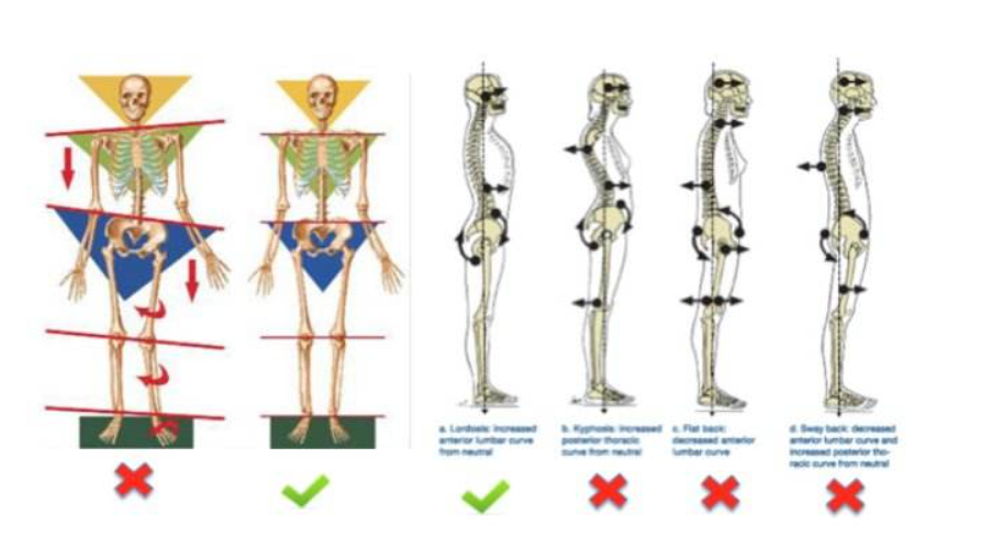 体态系列：正确的体态应该是如何的？ - 知乎