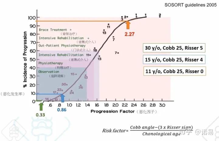 脊柱侧弯 - 知乎