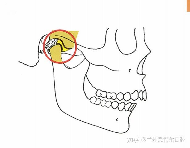 為什麼有些人牙齒矯正前要戴咬合板你的正畸醫生會在矯治前檢查你的顳