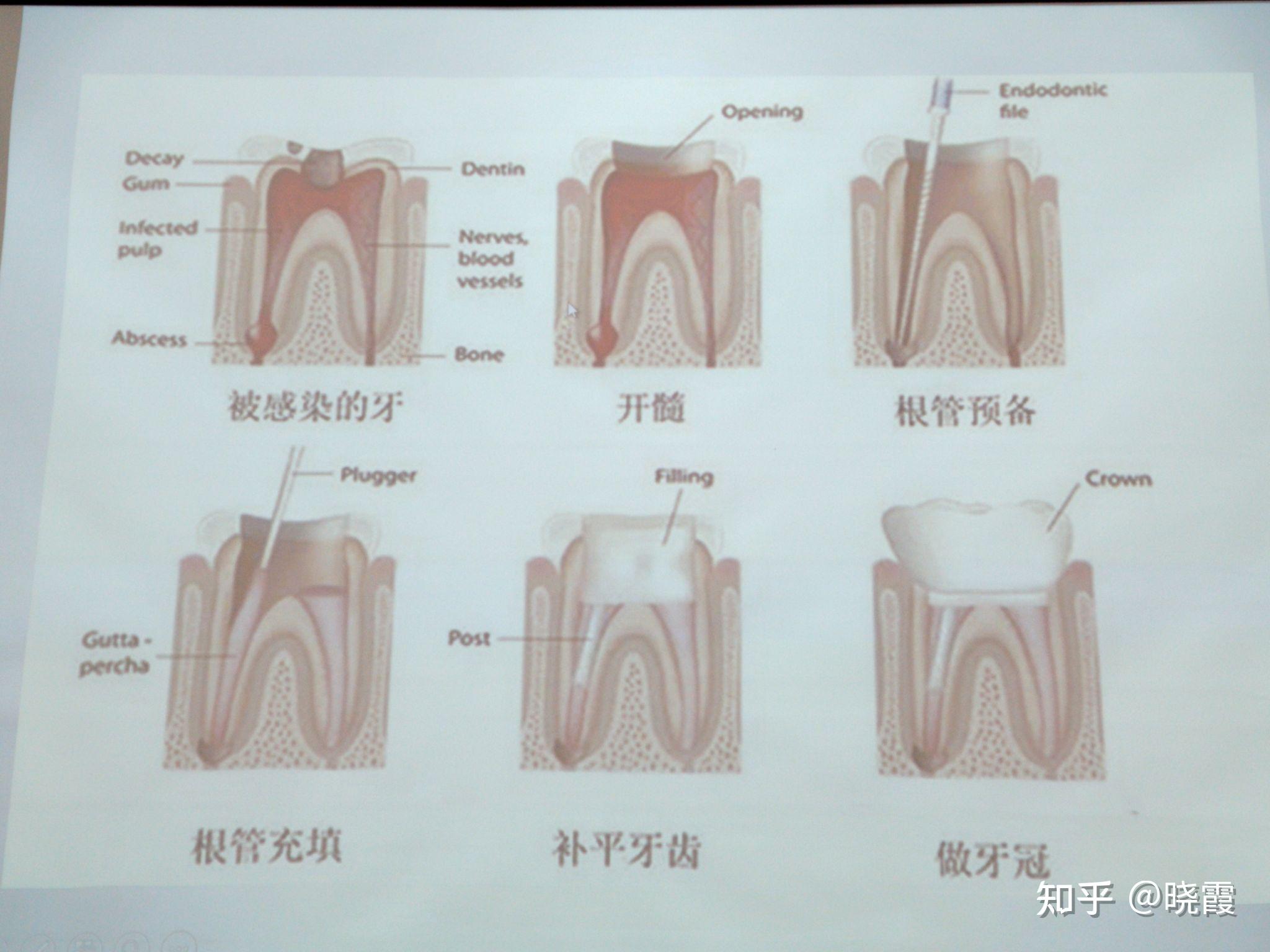 髓索和髓窦示意图图片