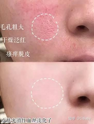 最健康的化妆品_健康化妆美容论文_聚美优品化妆品有假货么