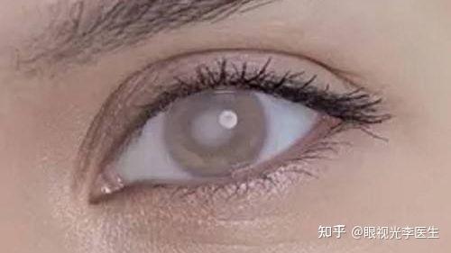 白瞳症的病因及预防 - 知乎