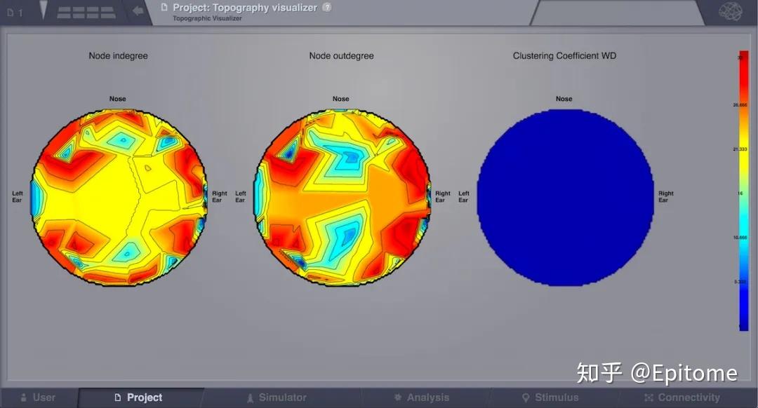 TheVirtualBrain: Brain Network Dynamics Simulator - 知乎