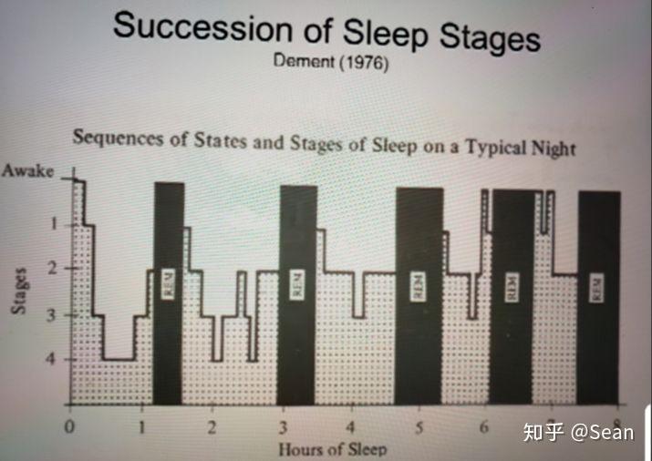 做梦是快速眼动状态吗?深度睡眠是什么状态?做梦的时候是深度睡眠吗?什么样的睡眠才是效率最高的? - 知乎