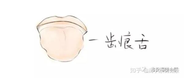 润康:中医看舌诊,到底看什么?润康中医教你从舌头了解自己的身体! - 知乎