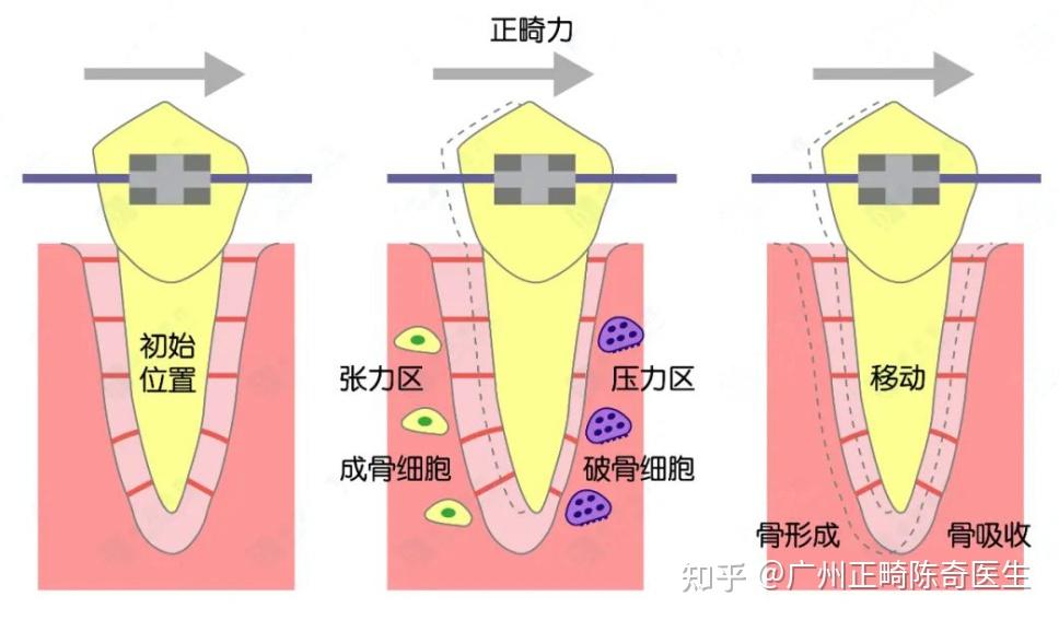 我們大家都知道,牙齒之所以能穩固不動,是因為牙齒的牙根深深地埋在牙