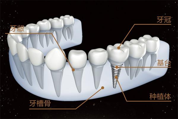 v2-03a37dbcba19a71b5e115a4d5eb4657a_1440w.jpg?source=172ae18b