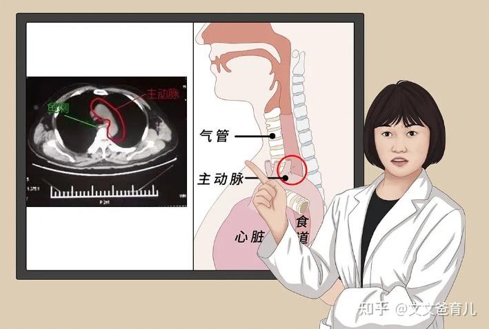 5岁儿子鱼刺卡喉,妈妈60秒处理很有用,医生:不用来医院 - 知乎