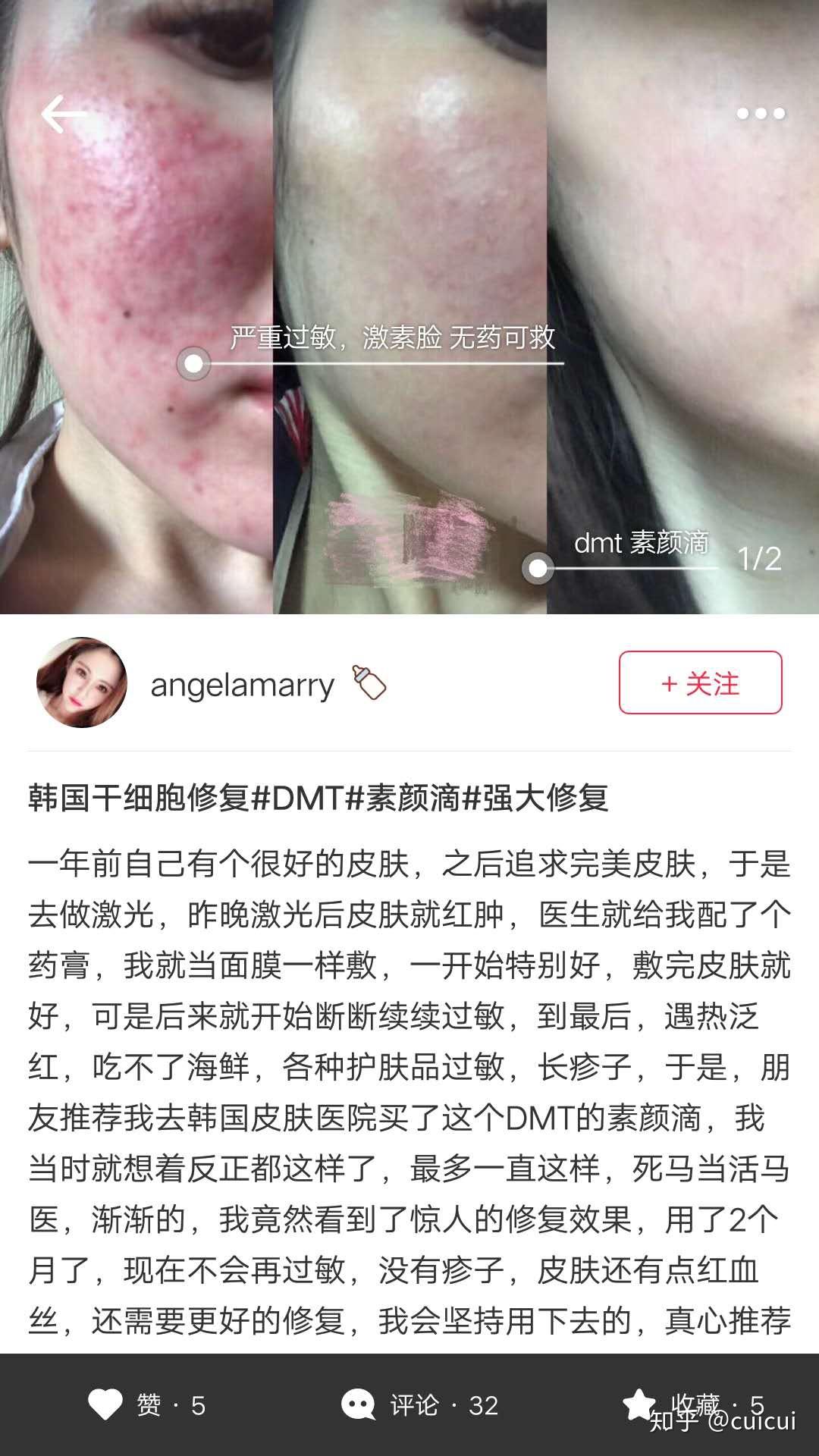 油性敏感皮肤用什么护肤品比较好呢?求推荐?