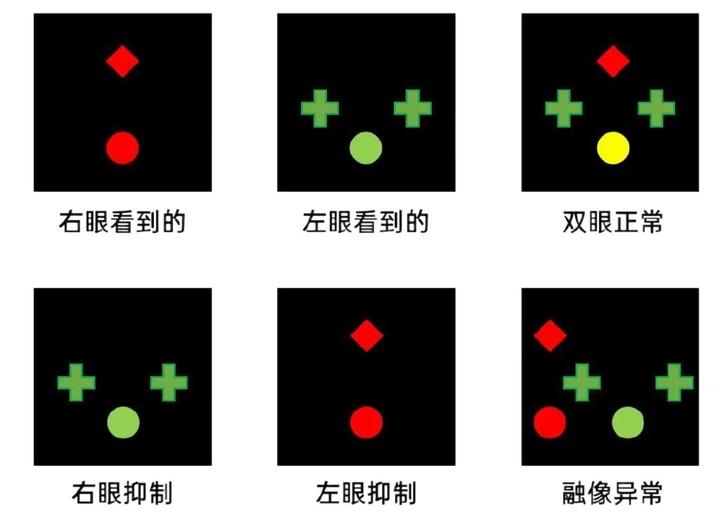 复视测试图图片