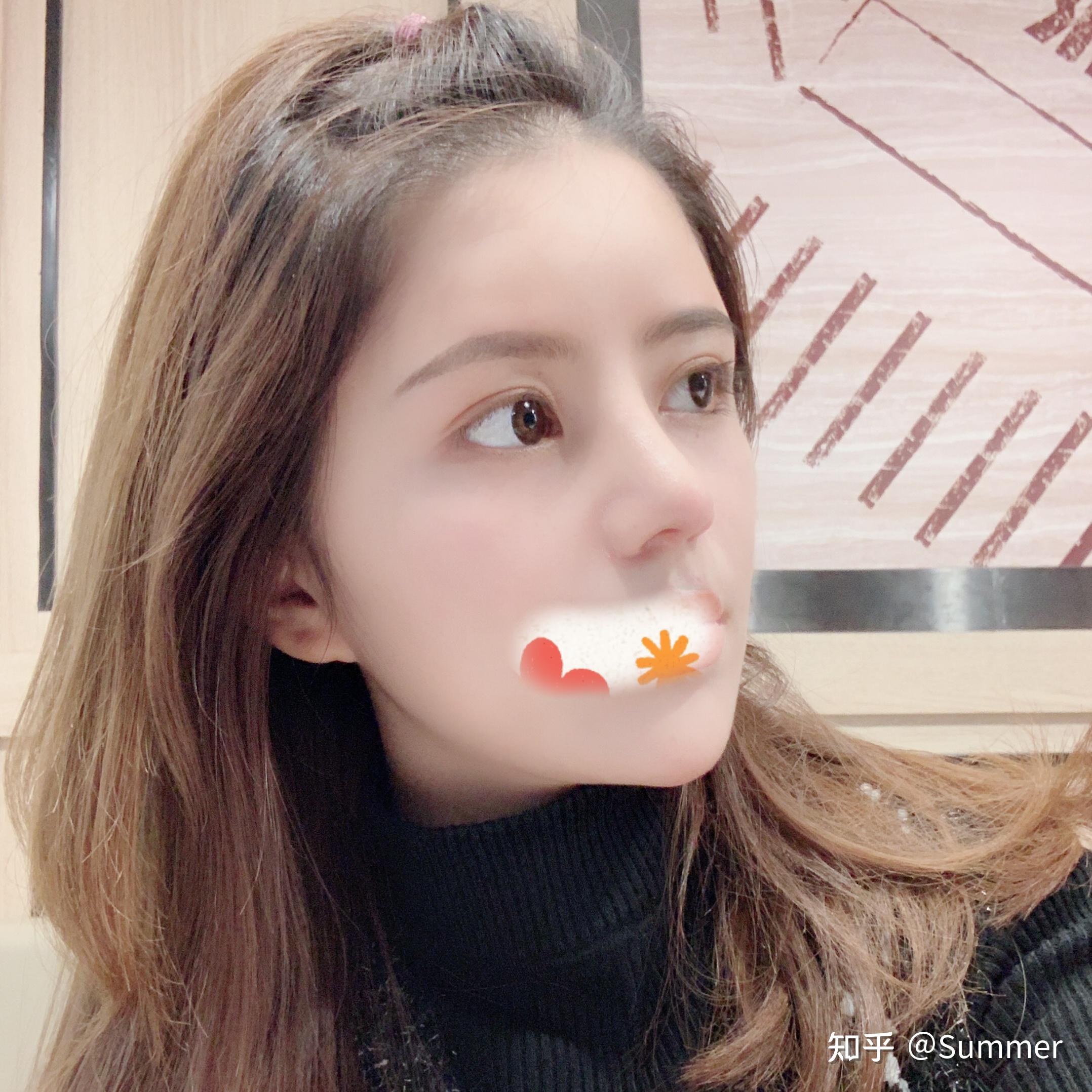 哪个医生妈生鼻做的好?