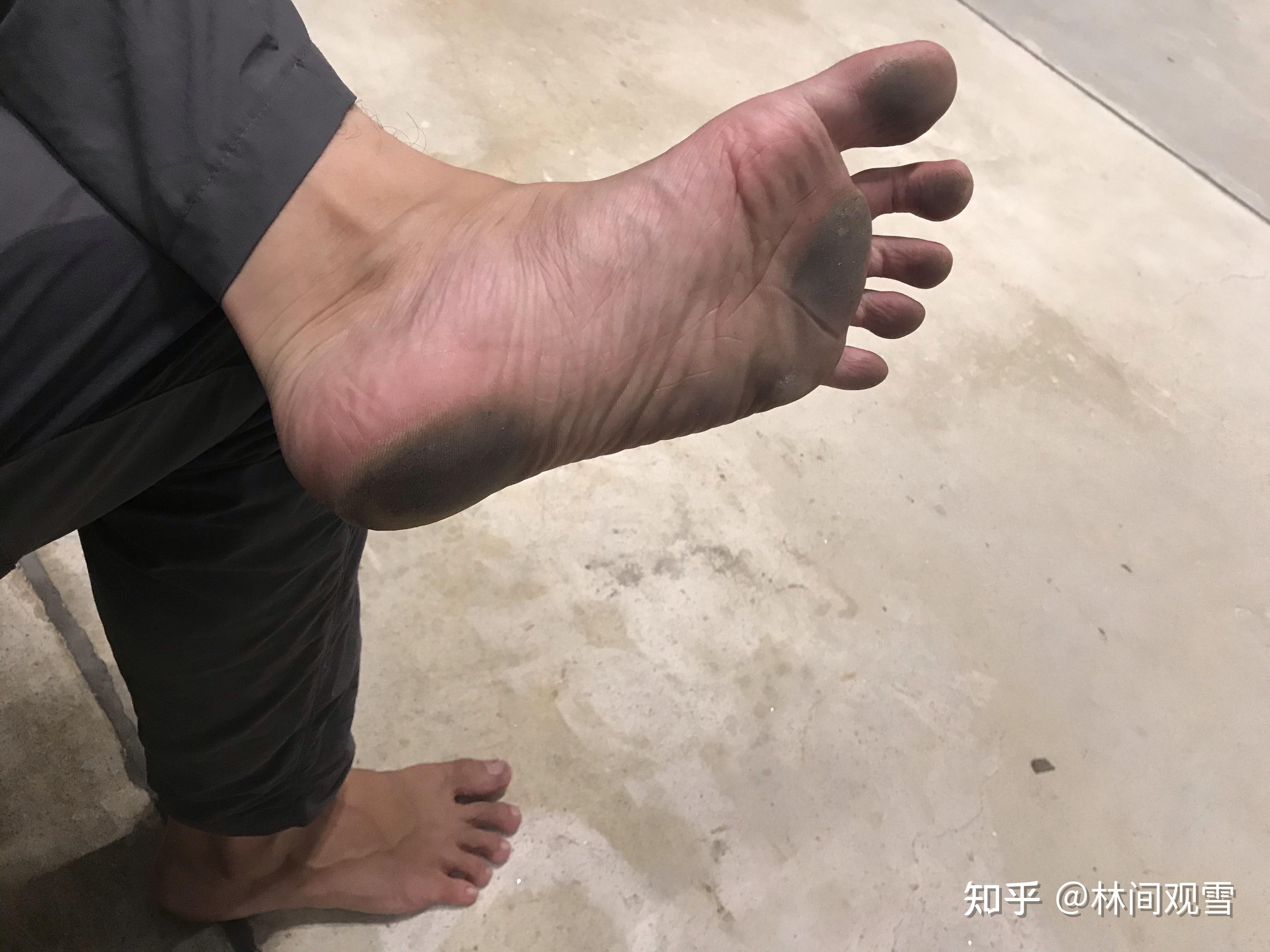 如果你在街上遇见一个赤脚的人,你的心里会想什么? - 知乎