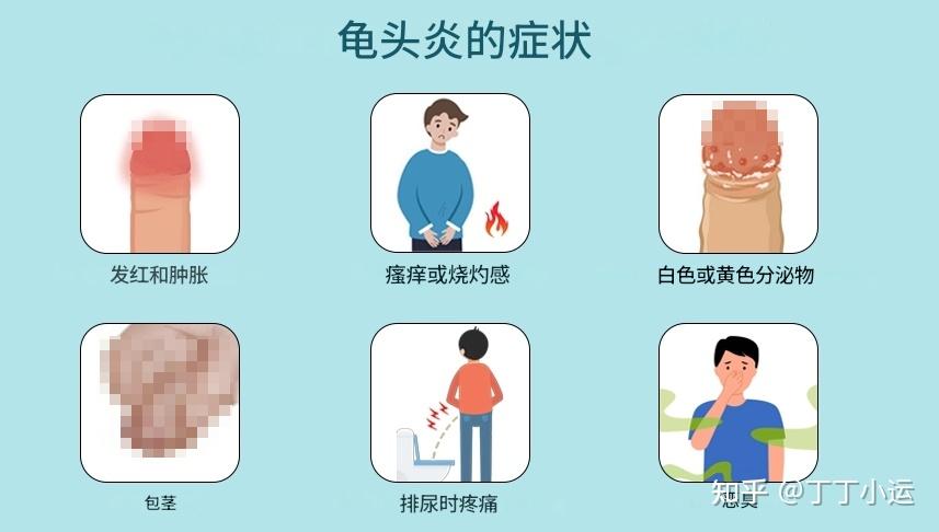 为什么包皮过长，会导致反复性的包皮龟头炎？ - 知乎