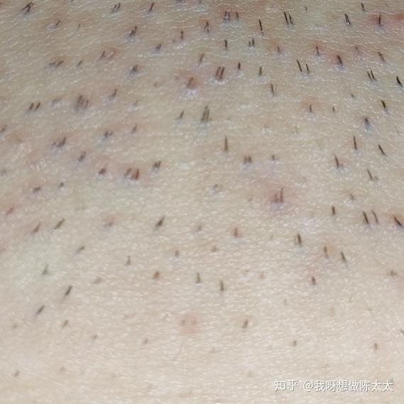 大概就是以前是毛茬