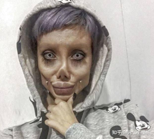 六例全球整容案例巴西狗头人的奇葩改造手术