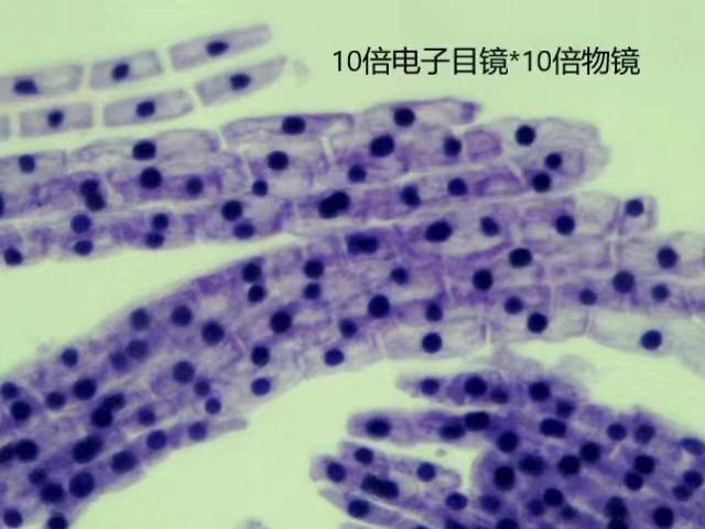 居家实验记录：洋葱根尖分生区组织细胞有丝分裂观察实验 - 知乎