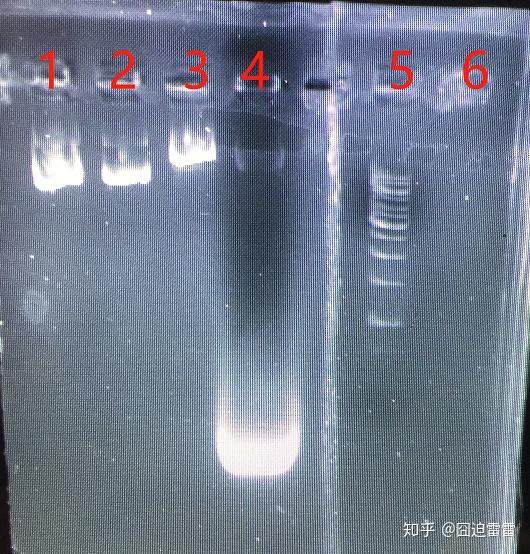 求助pcr电泳图怎么分析? - 知乎