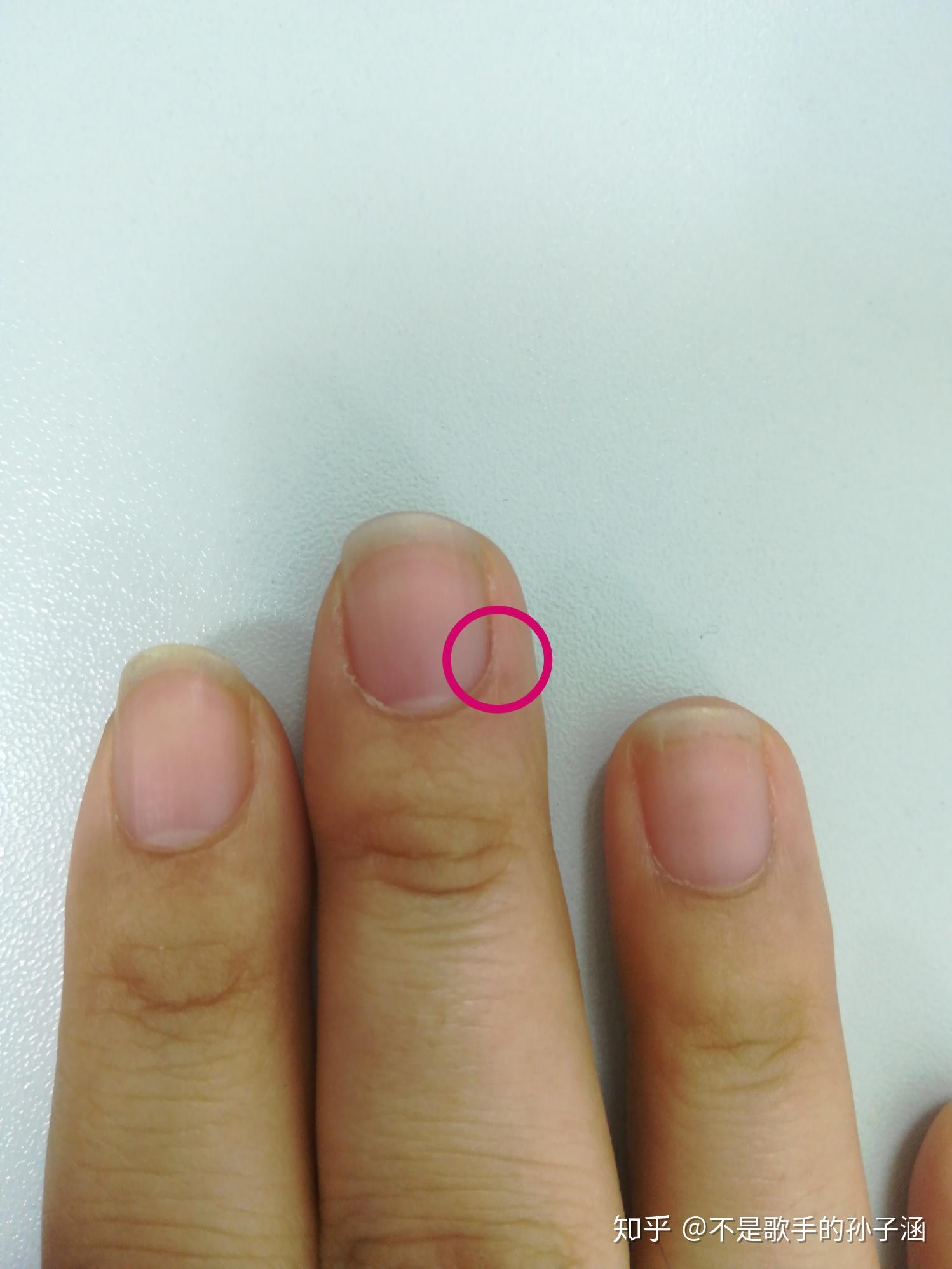 大家有没有这种情况比如指甲旁边的肉疼然后就想一直按着享受那种疼的